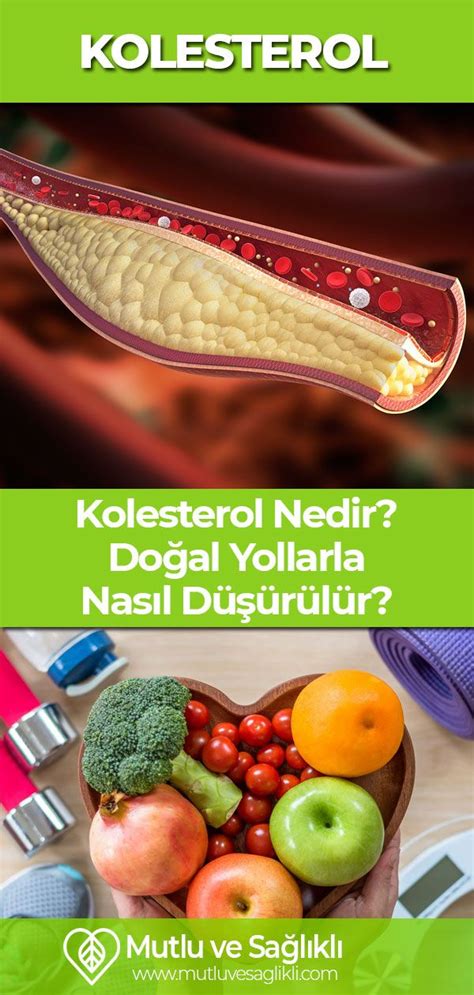 Kolesterol Düzeyi Nasıl Kontrol Edilir?